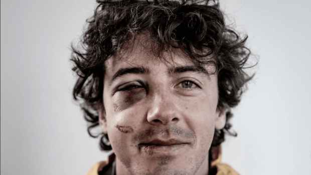 mark mcmorris injured